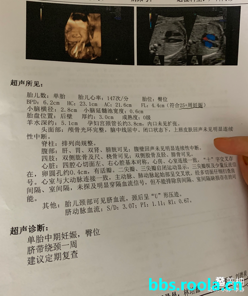 21087.jpg
