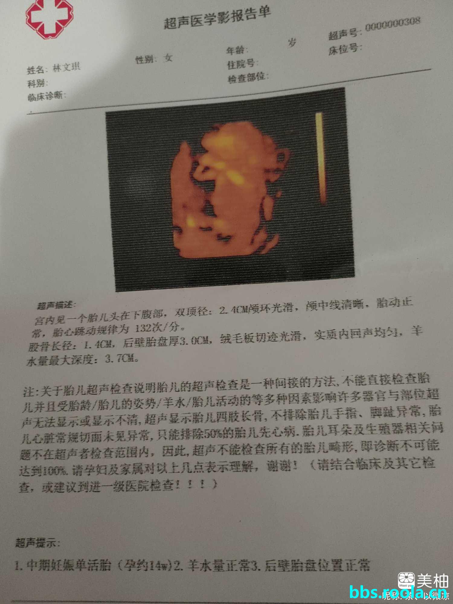 9225.jpg