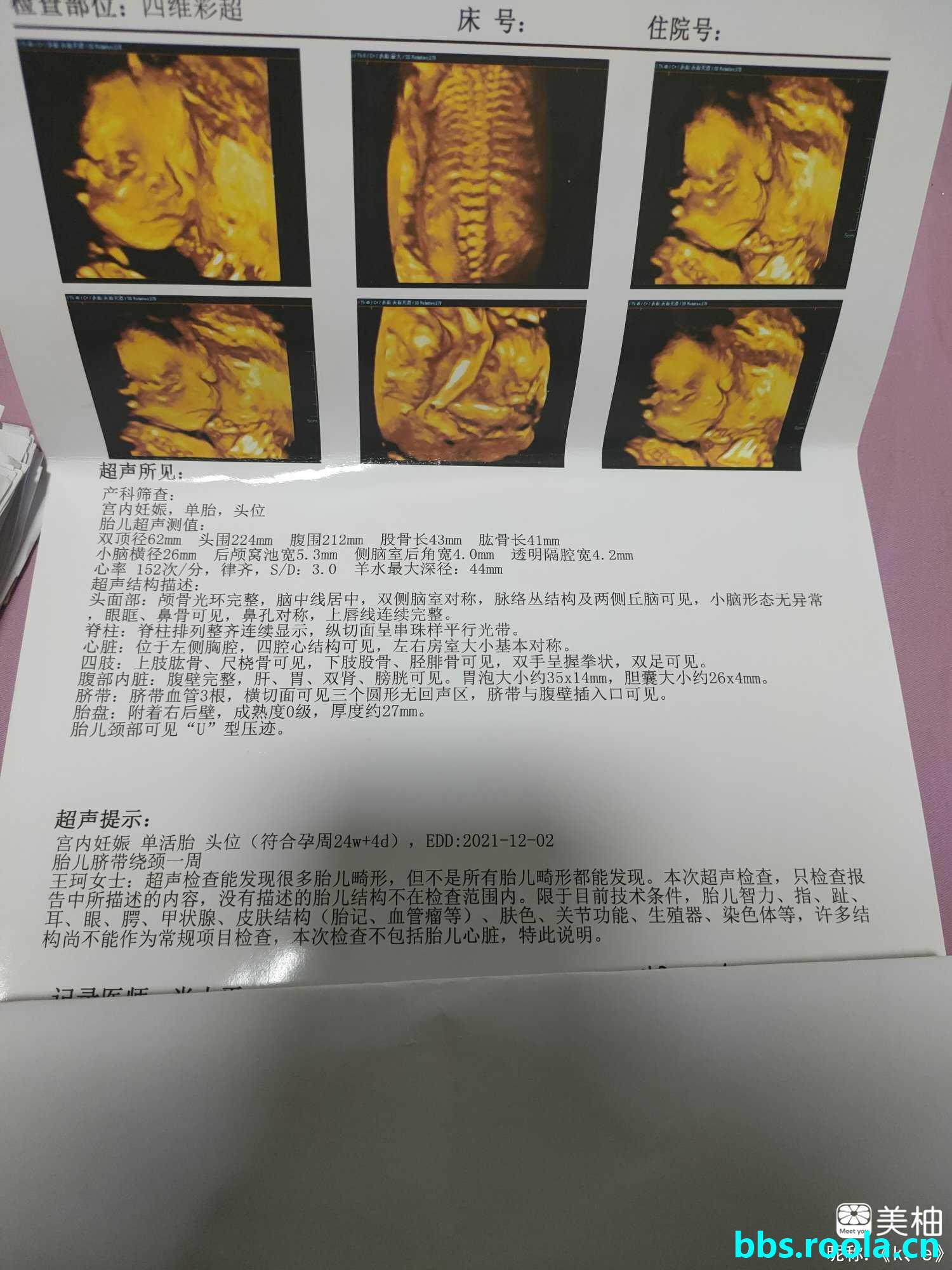 960.jpg
