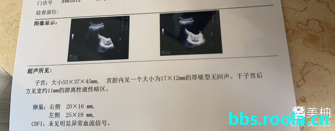 7172.jpg