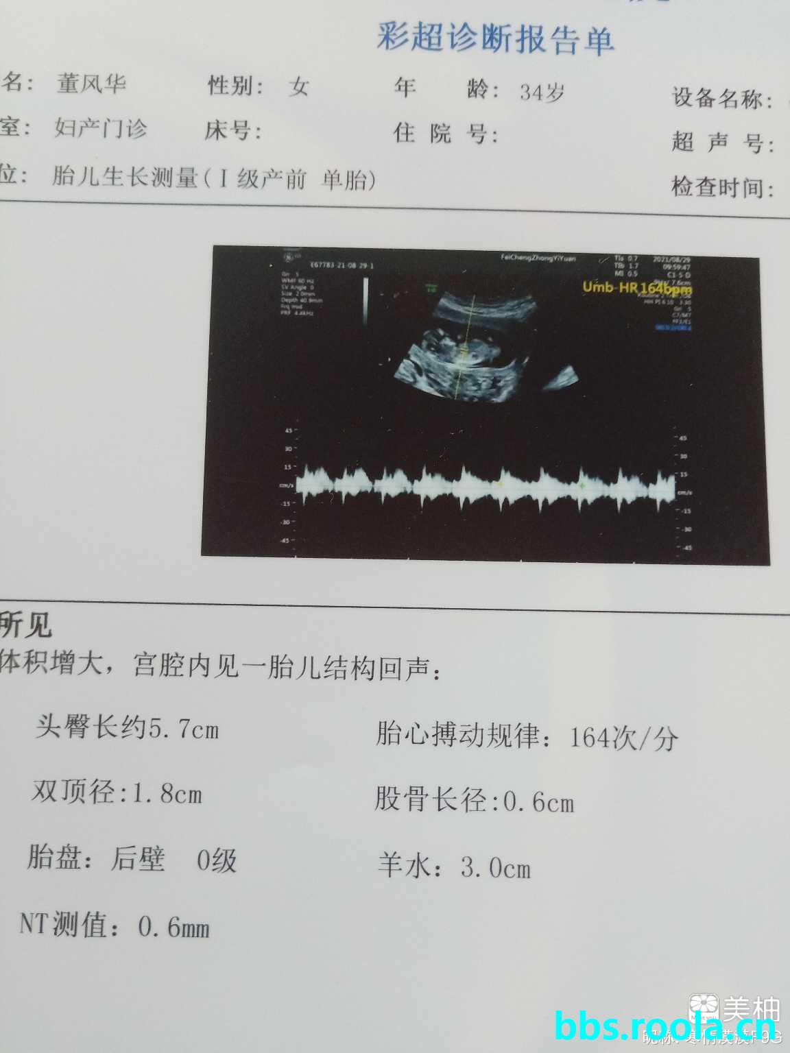 5160.jpg